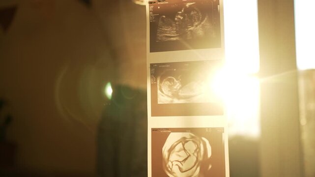 Pregnant woman holding an ultrasound scan of her baby, standing near a window with sunlight casting a warm glow and lens flare. The expectant mother is lovingly looking at the sonogram
