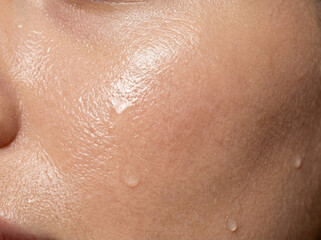 Fototapeta premium Extreme macro shot of authentic human skin with water drops and texture. Concept of deep hydration, sweat, and dermatology. Detailed pores and natural freckles in soft light.
