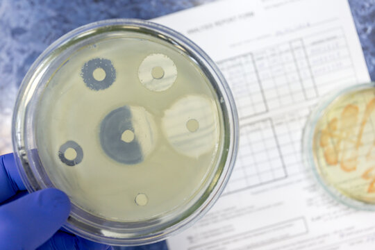 An antibiotic efficacy test that shows large and small zones on a Petri dish where bacteria do not grow. These zones inhibit bacterial growth when exposed to antibiotics.