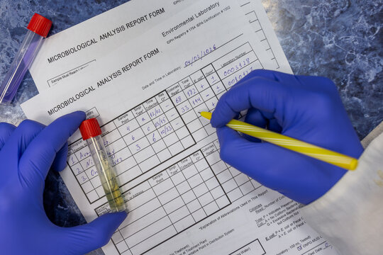 Filling out a laboratory test report by the attending physician, the doctor holds a test tube with the patient's test sample and writes with a ballpoint pen, close-up from above.