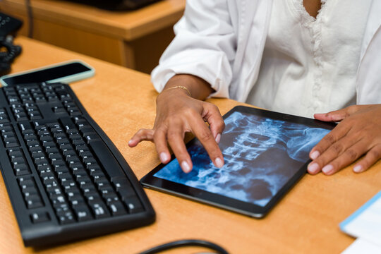 Doctor examining x-ray of spine on tablet screen