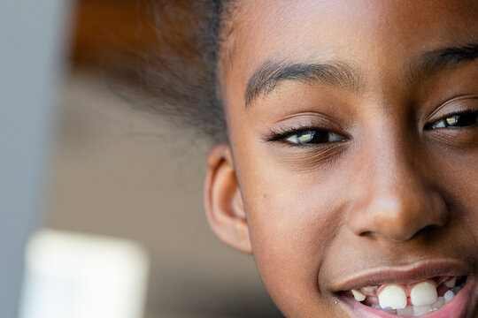 Right-side face is showing close skin texture, eyelashes and front tooth gap near window