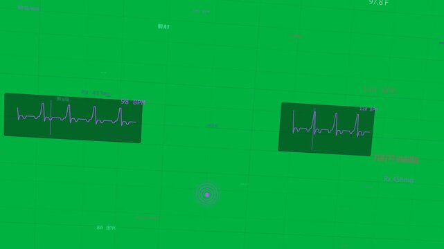 Health HUD on data spike, panning and updating ECG to monitor vitals, transparent background