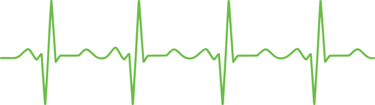 A graphical representation of an electrocardiogram heartbeat pattern displayed in green
