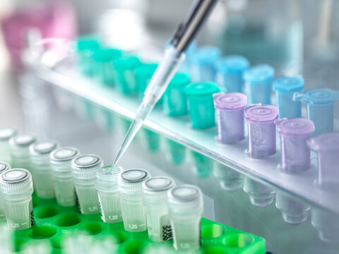 Scientist pipetting DNA sample in laboratory biotechnology research