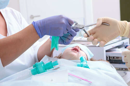 Installing cofferdam for child in treatment of baby teeth.Child is under anesthesia. Breathing tube in mouth. An open mouth. Modern dentistry. Treatment of baby teeth under anesthesia.