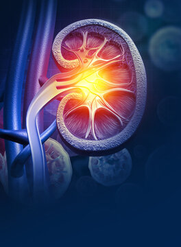Human Kidney Disease. Medical organ. Cross section. 3d illustration
