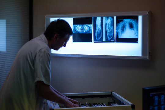 M&eacute;decin radiologue consulte dossiers avec radiographies sur visionneuse