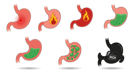Fototapeta premium Stomach Health and Digestive Issues A Comprehensive Visual Guide to Gastric Conditions.