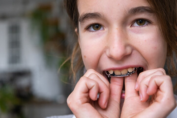 Orthodontic treatment process: girl age 9 inserting removable dental plate, appliance for pediatric smile correction. © Ольга Симонова