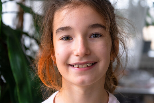 School-age girl demonstrates early orthodontic care with removable blue plate, smile improvement in children.