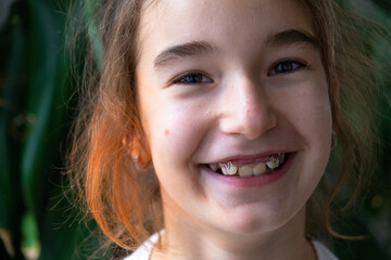 Fototapeta premium Smiling girl after early intervention orthodontics, healthy teeth and visible correct jaw arch.