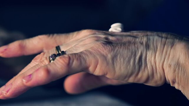 Close-up video of senior woman hands with visible vitiligo and ring on finger while applying moisturizing cream. Concept of skincare routine, dermatology, skin condition awareness, aging, self care