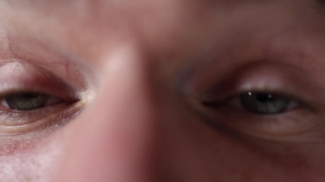 Closeup shows eyes wide open in sudden panic as pupils expand and eyelids tense capturing an intense emotional reaction to unexpected fear in a realistic macro moment