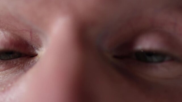 Closeup captures eyes widening in confused fear as the gaze freezes trying to process an unexpected situation blending surprise uncertainty and mild panic in a realistic macro moment