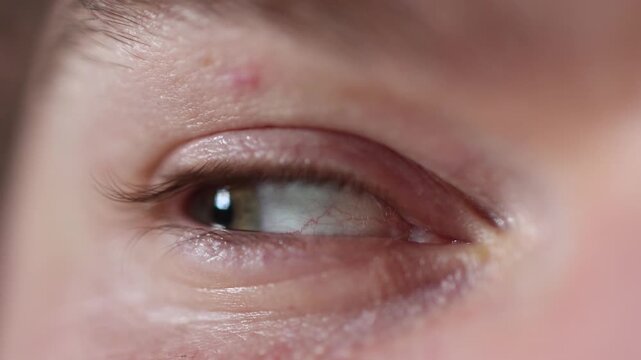 Closeup captures an eye looking sharply to the side showing natural skin folds fine lines and realistic motion around the eyelid emphasizing a focused sideways glance in macro detail