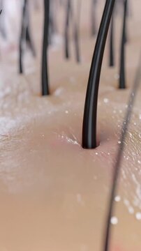 【縦動画】頭皮の赤い湿疹や炎症が治る3DCGアニメーション　顕微鏡イメージ