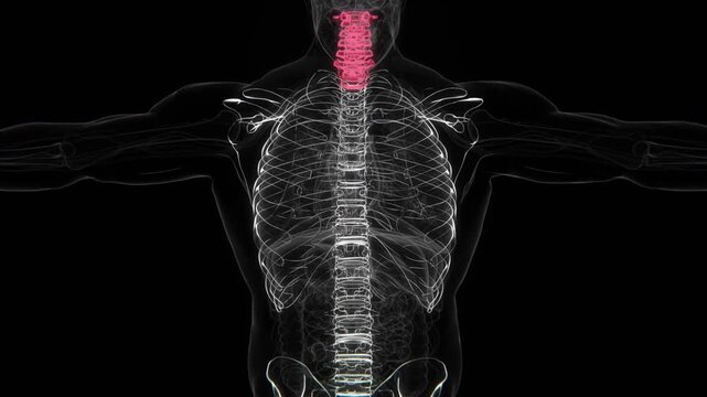 Ankylosing spondylitis Indication X-ray video in HD | Spondylosis spine X-ray HD video