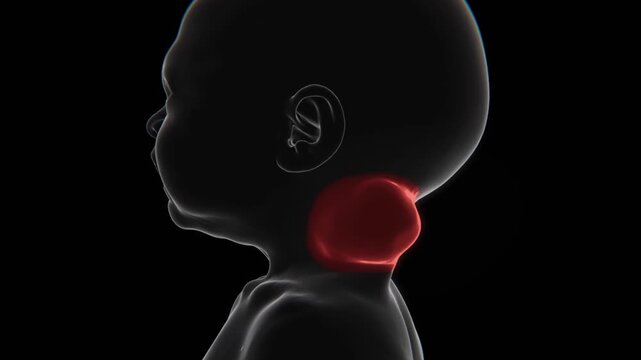 X-Ray video of Cystic hygroma in baby | Cystic hygroma Video in X-Ray | Cystic hygroma indication video in HD format