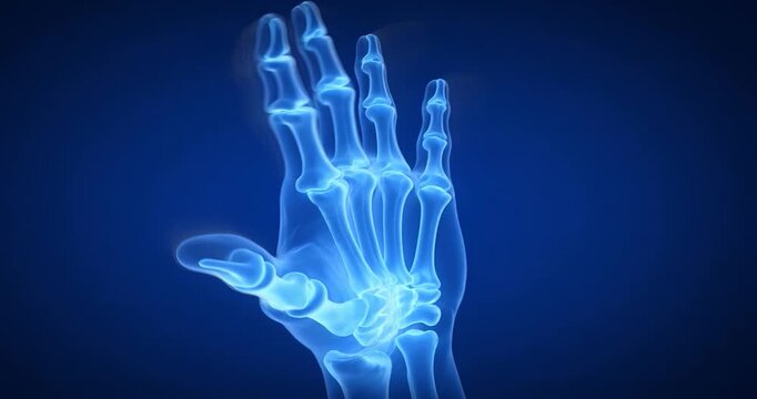 X-ray image of a human hand showing bones and joints xray bone skeleton medical anatomy