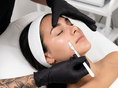 Dermaplaning facial treatment on beautiful young woman with glowing skin by beautician using a scalpel at aesthetic spa clinic