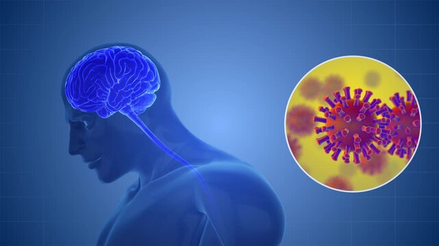 Brain Encephalitis Caused by Nipah Virus