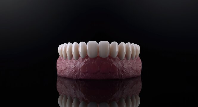 Dental implants carrying fixed full arch prostheses showcased on black background