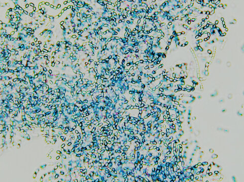 Microorganism or virus cells, algae microorganism cells under microscope. Rapid multiplication of bacteria. Infection and germ. Microbiology, popular scientific black background