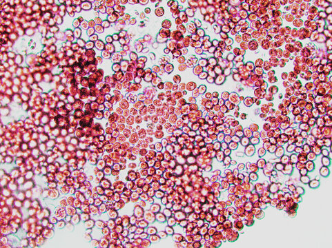 Microorganism or virus cells, algae microorganism cells under microscope. Rapid multiplication of bacteria. Infection and germ. Microbiology, popular scientific black background