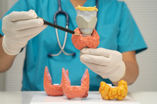 Hyperthyroidism, Overactive Thyroid, Thyroid Lymphoma, Asian doctor with thyroid gland human anatomy model in hospital.
