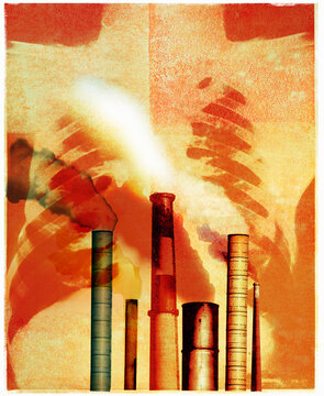 Pollution from factory emissions and chest problems