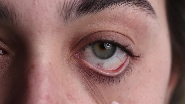 4K video macro closeup of young woman pulling down lower eyelid with finger while looking at camera, no makeup and natural expression, studio shot on white background
