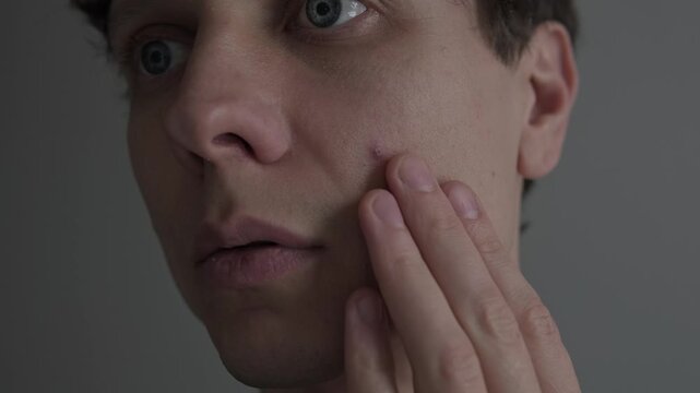 Single pimple on male face, extreme macro skin texture, acne and blemish problem, realistic skincare concept.