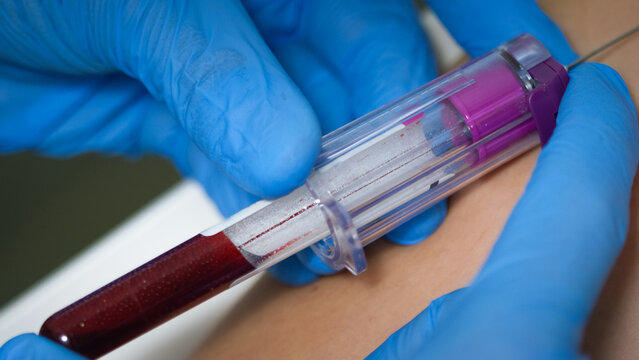 A healthcare worker is drawing blood from a patients arm using a needle and test tube in a medical clinic.