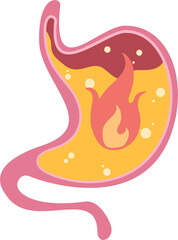 Illustration of a stomach with inflammation and burning sensation