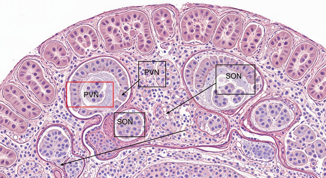 Histological view of the hypophysis with labeled neurosecretory nuclei SON, PVN, and SOH