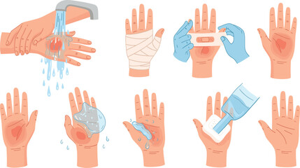 Fototapeta premium Hand Burn First Aid Treatment Steps Vector Illustration with Running Water Cooling, Sterile Bandaging, Antiseptic Care, and Wound Healing Process Guide