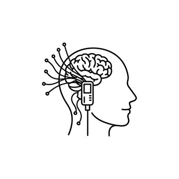 Brain with electrodes on head side.