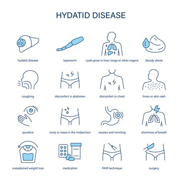 Hydatid Disease symptoms, diagnostic and treatment vector icon set