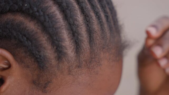 Indepth scalp and strand review. Close inspection of hair roots and scalp characteristics observed. Comprehensive detailed analysis focusing on hair strands and scalp features closely examined