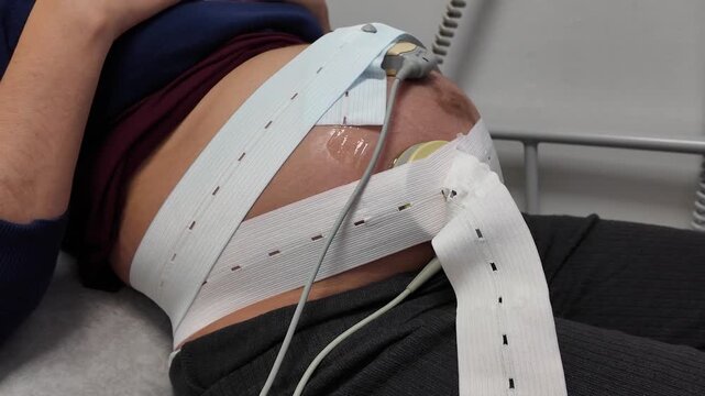 Pregnant woman receiving fetal monitoring in hospital