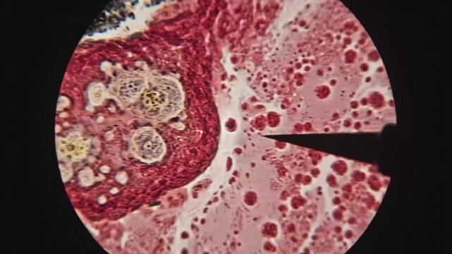 Microscopic view of inflamed epidermal tissue revealing intricate cellular structures and signs of inflammation.