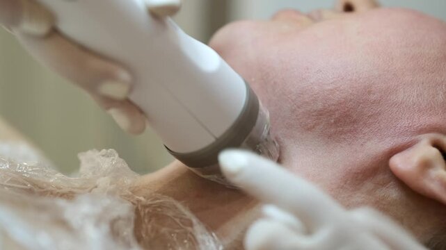 Macro close-up of a woman receiving a non-invasive laser facial treatment in a professional beauty clinic. A cosmetologist wearing protective gloves performs skin rejuvenation using advanced aesthetic
