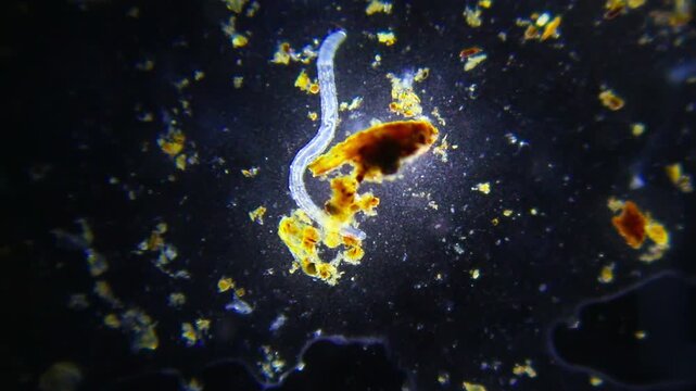 Annelid worm with ciliates and bacteria under 40x bright field microscopy. 4K scientific microscopy footage.