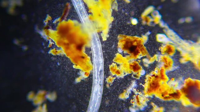 Annelid worm with ciliates and bacteria under 100x dark field microscopy. 4K scientific microscopy footage.