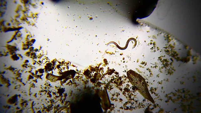 Nematode moving in figure eight pattern around sand particles under 40x bright field microscopy. 4K scientific microscopy footage.