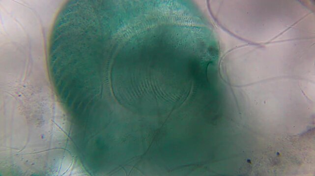 Stentor ciliate showing cilia and body structure under 400x bright field microscopy. 4K scientific microscopy footage.