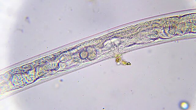 Nematode showing internal eggs of developing nematodes under 400x bright field microscopy. 4K scientific microscopy footage.