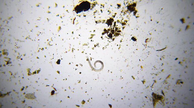 Nematode exhibiting bending and coiling locomotion around sand particles under 40x bright field microscopy. 4K scientific microscopy footage.