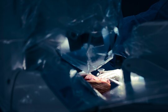 Surgeon in sterile blue gown expertly navigates a robotic arm in a high-tech operating room, enhancing precision in total knee arthroplasty with advanced technology
